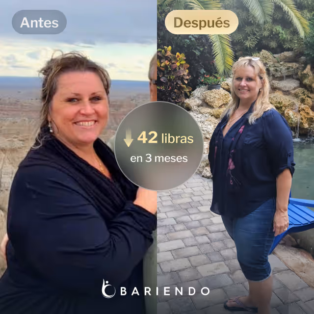 Imágenes de Lisa antes y después de perder 42 libras en 3 meses gracias a un procedimiento ESG