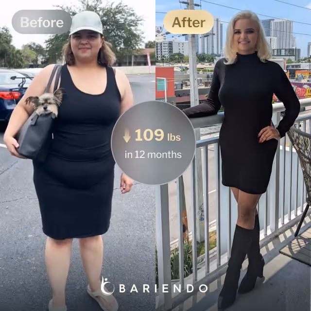 Before and after images of Nicole, a Bariendo ESG Stomach Tightening® patient who lose 109 pounds in 12 months
