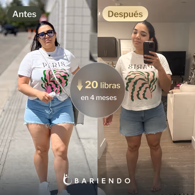 Imagen del antes y después de Ruxibeth que perdió 20 libras en 4 meses con un procedimiento de balón gástrico