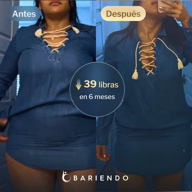 Imágenes de antes y después de Daniela, quien perdió 39 libras en 6 meses tras un balón gástrico con Bariendo.