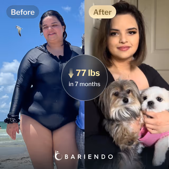 Before and after images of Nicole, a Bariendo ESG Stomach Tightening® patient who lose 77 pounds in 7 months