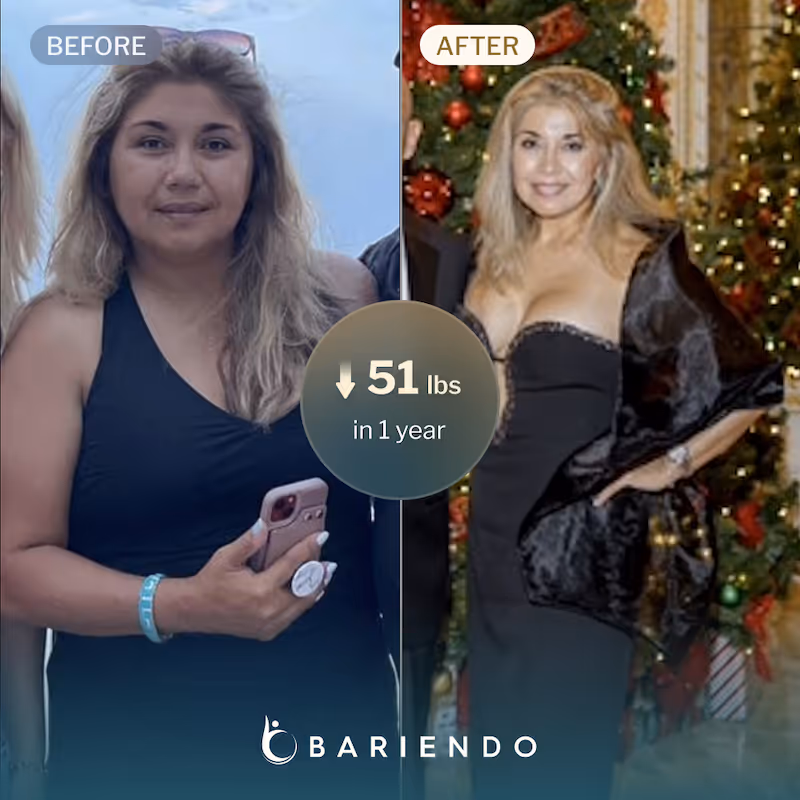 Before and after image of Amelia who lost 51 lbs with ESG