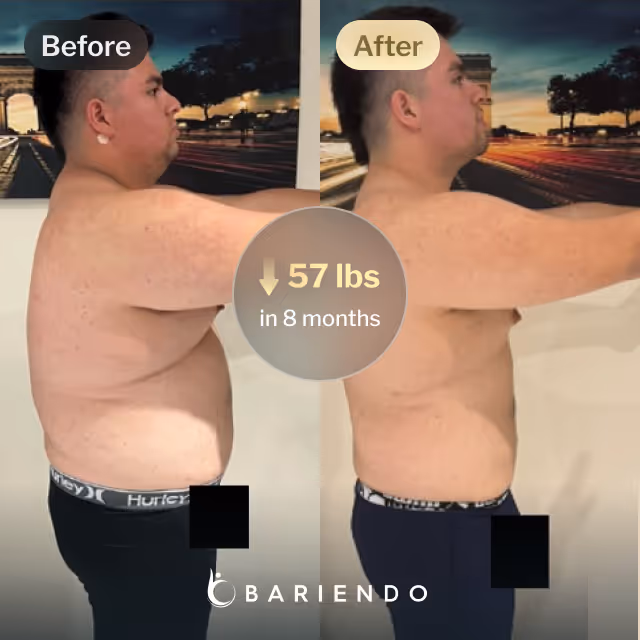 Before and after images of Javier who lost 57 pounds in 8 months after an ESG procedure