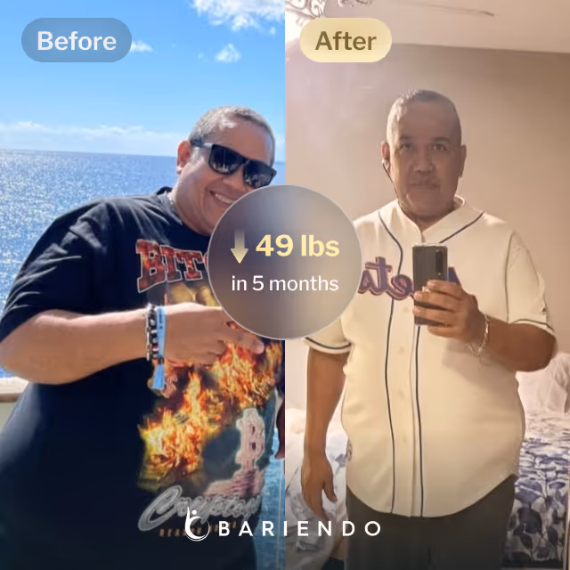 Before and after images of Cesar who lost 49 pounds in 5 months through Bariendo's ESG Stomach Tightening® procedure