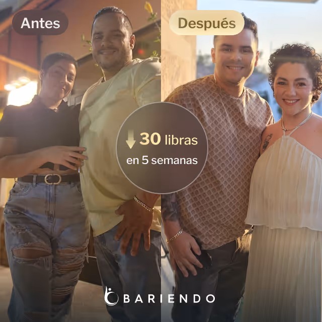 Imágenes de antes y después de Rey que perdió 30 libras en 5 semanas después de un procedimiento ESG con Bariendo