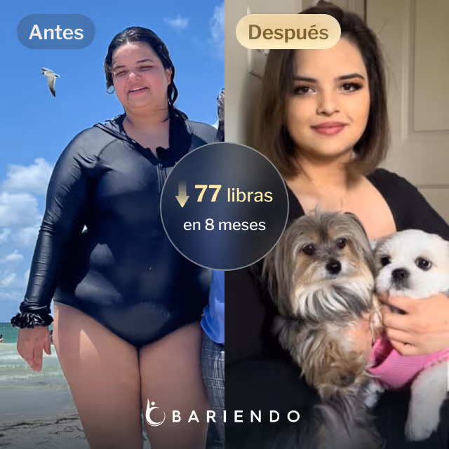 Imágenes de antes y después de Nicole, una paciente de Bariendo ESG que se endurece el estómago y que pierde 77 libras en 7 meses
