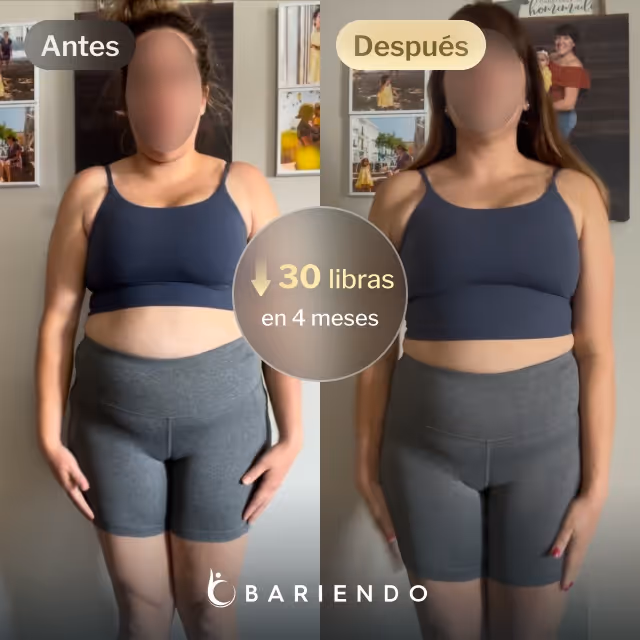 Imágenes de antes y después de Iris, quien perdió 30 libras en 4 meses después de un procedimiento de Balón Gástrico con Bariendo