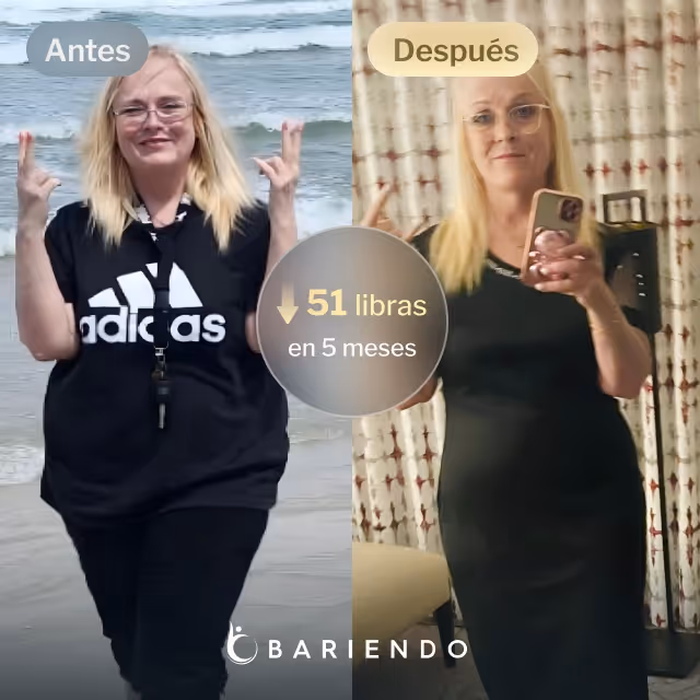 Imágenes de antes y después de Jackie, quien perdió 51 libras en 5 meses después de un procedimiento TORe con Bariendo