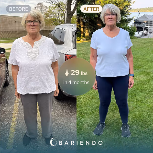 Before and after picture of an older blonde woman showing weight loss progress with ESG stomach tightening