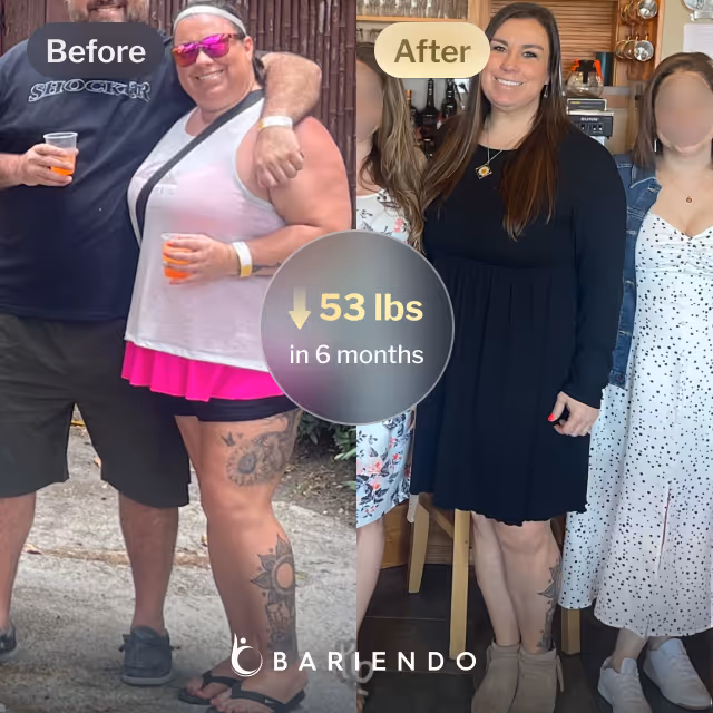 Before and after images of Mindi who lost 53 pounds in 6 months through Bariendo's non-surgical revision procedure