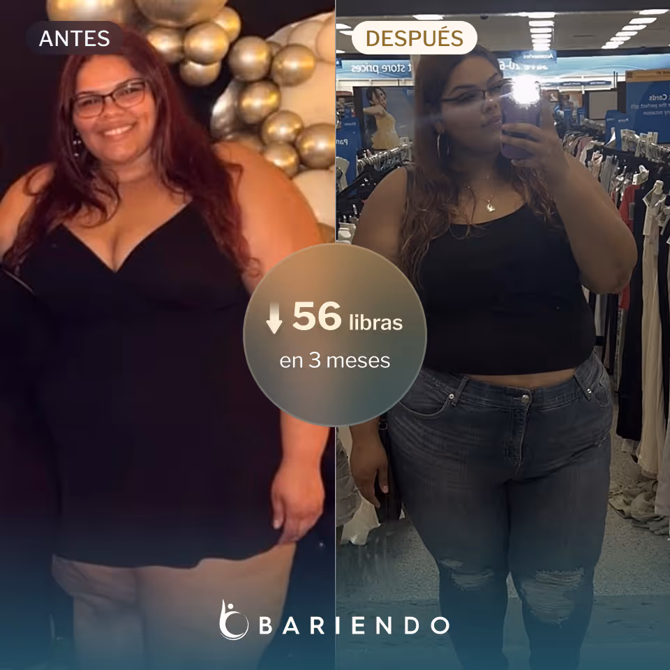 Ciaralyn lost 56 pounds with an ESG from Bariendo