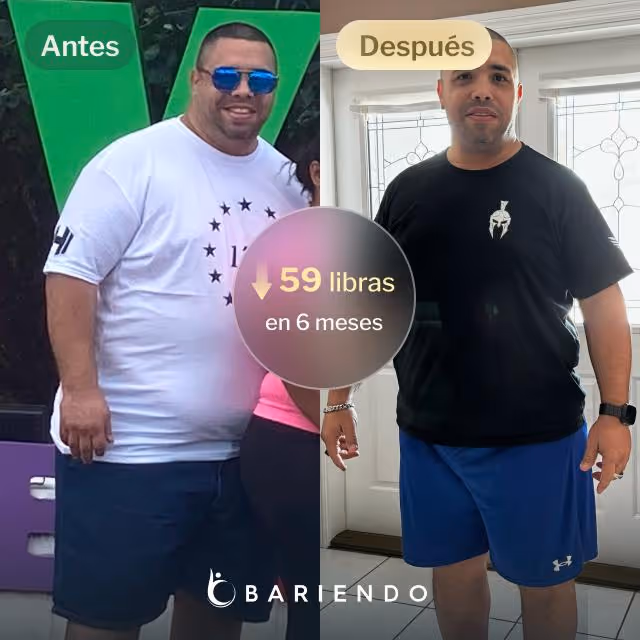 Imágenes de antes y después de Oscar, quien perdió 59 libras en 6 meses a través del procedimiento de Reducción de Estómago ESG de Bariendo.