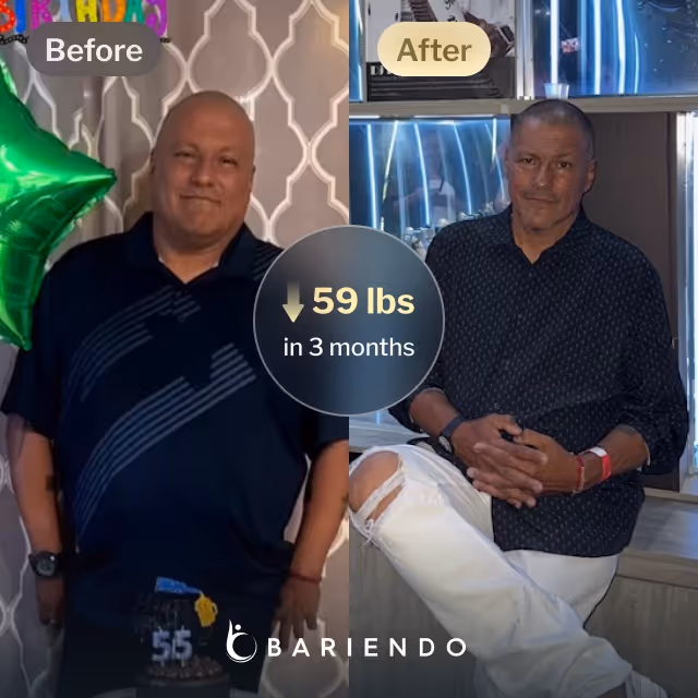 Before and after images of Hernando who lost 59 pounds in 3 months after a ESG procedure with Bariendo