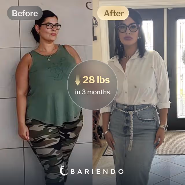 Before and after images of Candy who lost 28 pounds in 3 month through Bariendo's ESG Stomach Tightening® procedure