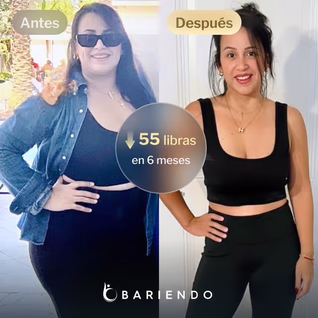 Imágenes de antes y después de Anaís, quien perdió 55 libras en 6 meses tras un balón gástrico con Bariendo.