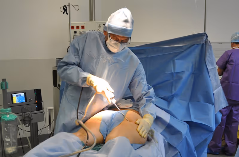 Cirujano realizando una liposucción