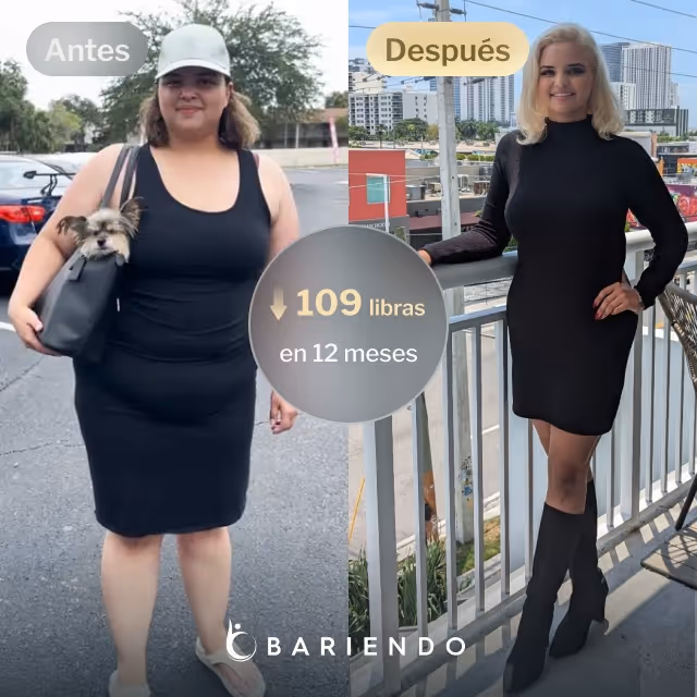 Imágenes de antes y después de Nicole, una paciente de Bariendo ESG que se endurece el estómago y que pierde 109 libras en 12 meses