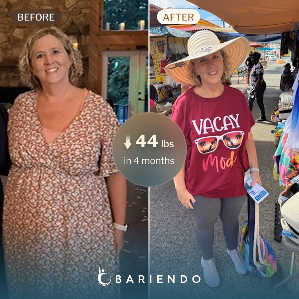 Christina before and after