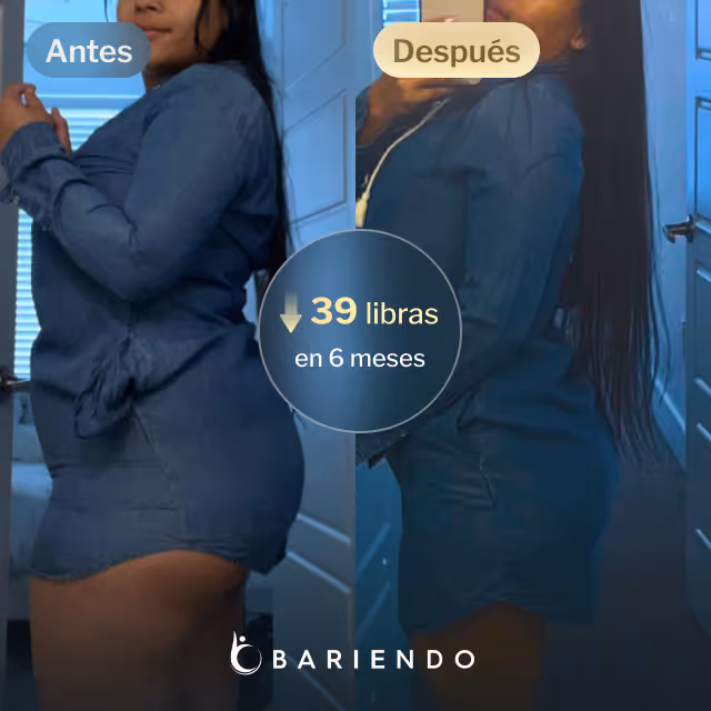 Imágenes de antes y después de Daniela, quien perdió 39 libras en 6 meses tras un balón gástrico con Bariendo.