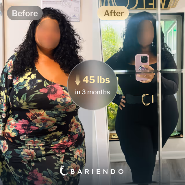 Before and after images of Erin who lost 45 pounds in 3 months after a Revision of Sleeve Gastrectomy Procedure - SIS with Bariendo