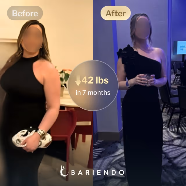 Before and after images of Natalie who lost 42 pounds in 7 months after a ESG procedure with Bariendo