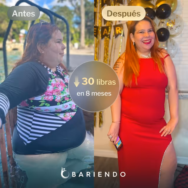 Imágenes de antes y después de Isola, quien perdió 30 libras en 8 meses tras un procedimiento de Balón Gástrico con Bariendo
