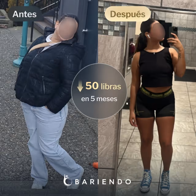 Imágenes de antes y después de Margarett, una paciente de balón gástrico en Bariendo, quien perdió 50 libras en 5 meses