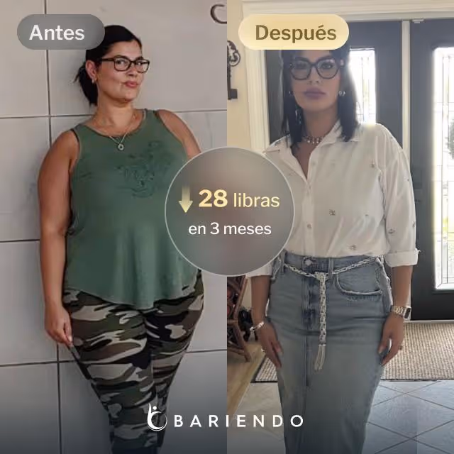 Imágenes de antes y después de Candy, quien perdió 28 libras en 3 meses a través del procedimiento de Reducción de Estómago ESG de Bariendo.