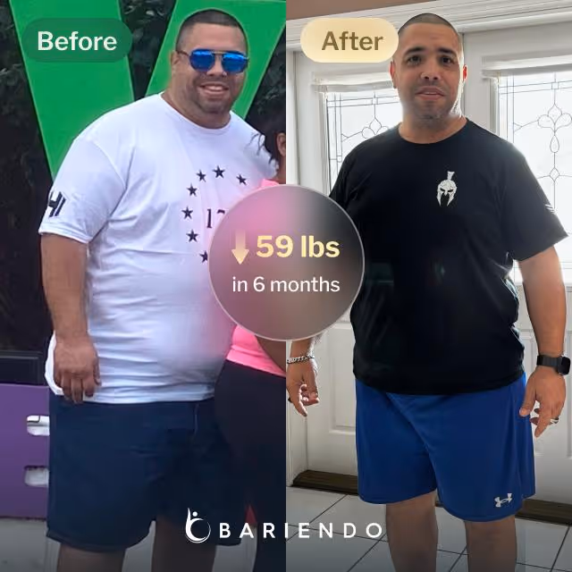 Before and after images of Oscar who lost 59 pounds in 6 month through Bariendo's ESG Stomach Tightening® procedure