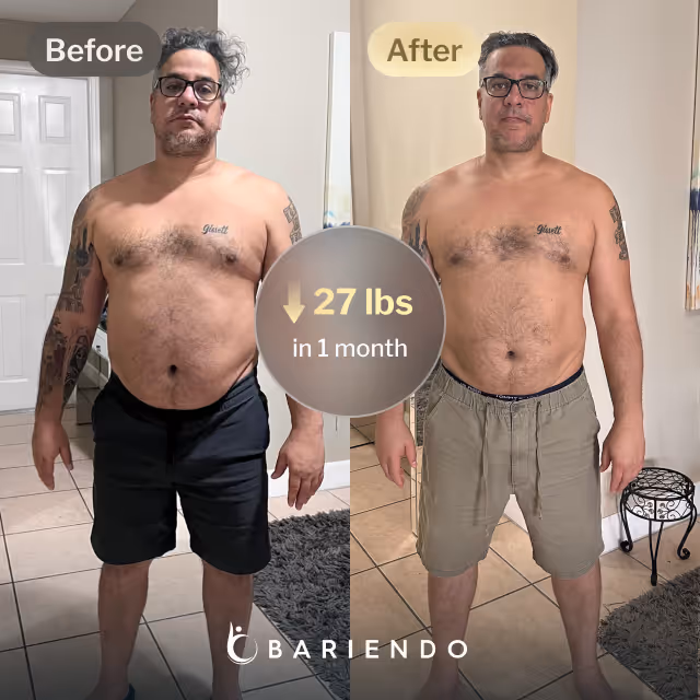 Before and after images of Cesar who lost 27 pounds in 1 month through Bariendo's ESG Stomach Tightening® procedure