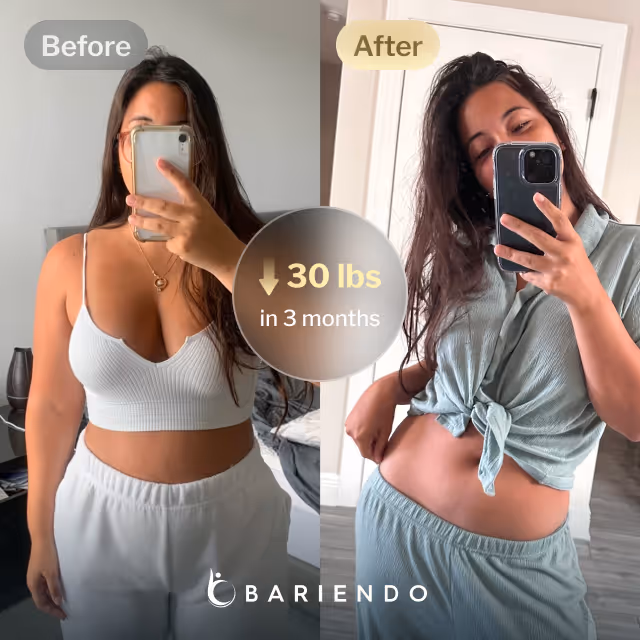 Before and after images of Patricia, a Bariendo ESG Stomach Tightening® patient who lost 30 pounds in 3 months