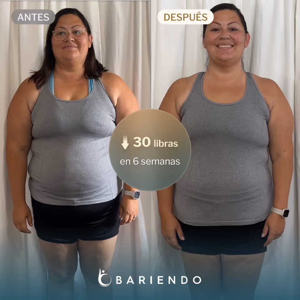 Lacy perdió 30 libras con ESG de Bariendo