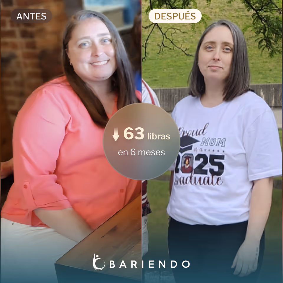 Helen tuvo un nuevo comienzo y perdió 63 libras con un ESG de Bariendo