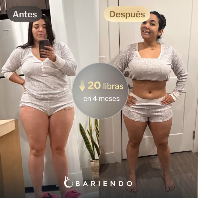 Imagen del antes y después de Ruxibeth que perdió 20 libras en 4 meses con un procedimiento de balón gástrico
