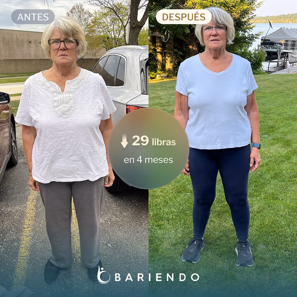 Karen perdió 29 libras con un ESG de Bariendo