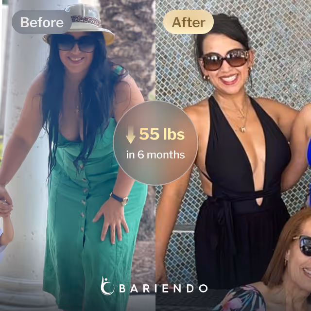 Before and after images of Anais who lost 55 pounds in 6 months after a Gastric Balloon procedure with Bariendo